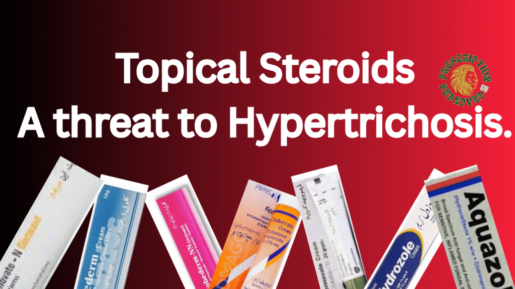 topical steroids - a threat to hypertrichosis