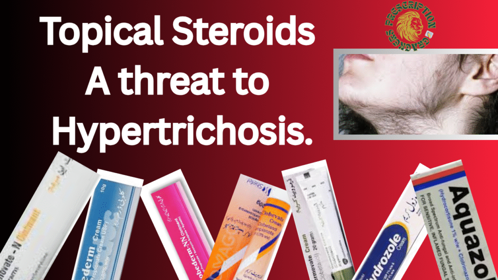 Topical steroids- a threat to hypertrichosis.