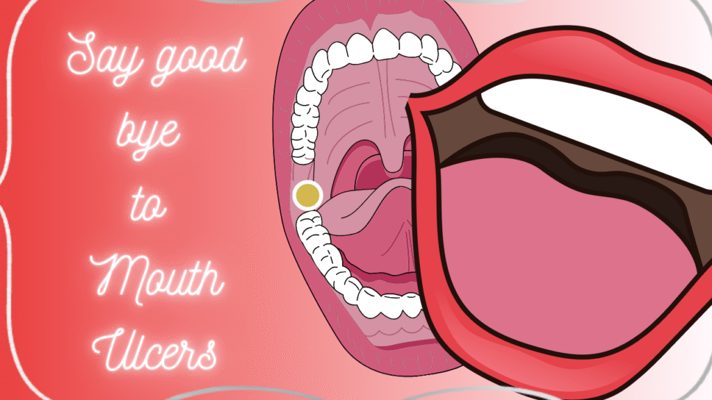 SAY GOOD BY TO MOUTH ULCERS